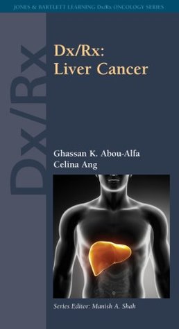 Download Dx/Rx: Liver Cancer: Liver Cancer (Jones & Bartlett Learning DX/RX Oncology) - Ghassan K. Abou-Alfa | ePub